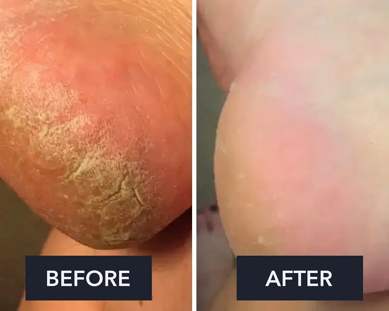 Swissclear Foot Cream