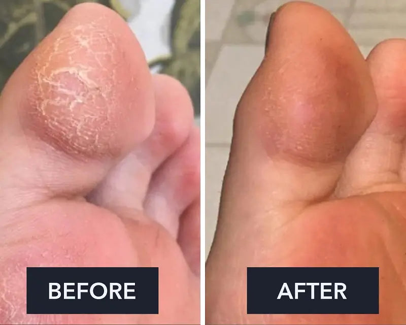 Swissclear Foot Cream