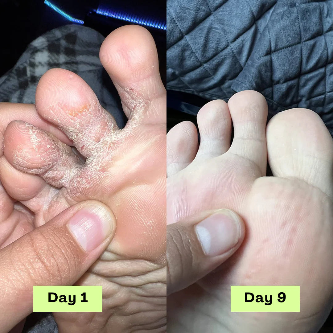 Swissclear Antifungal Soap