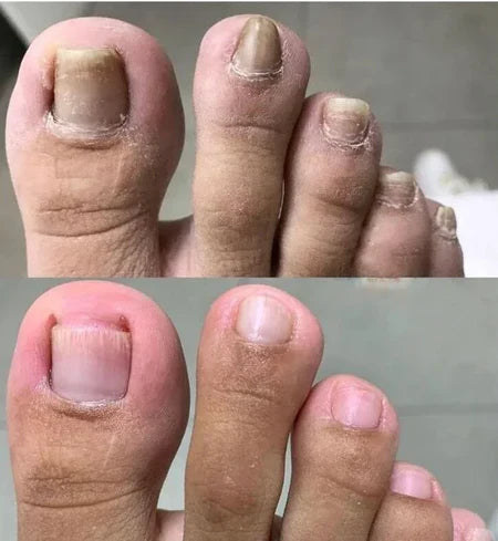 SwissClear Foot Soak - Your path to healthier Nails