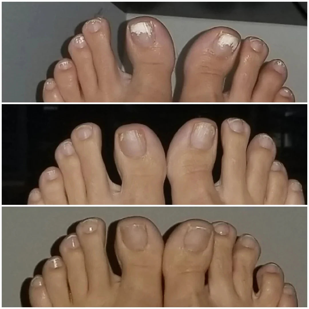 SwissClear Foot Soak - Your path to healthier Nails