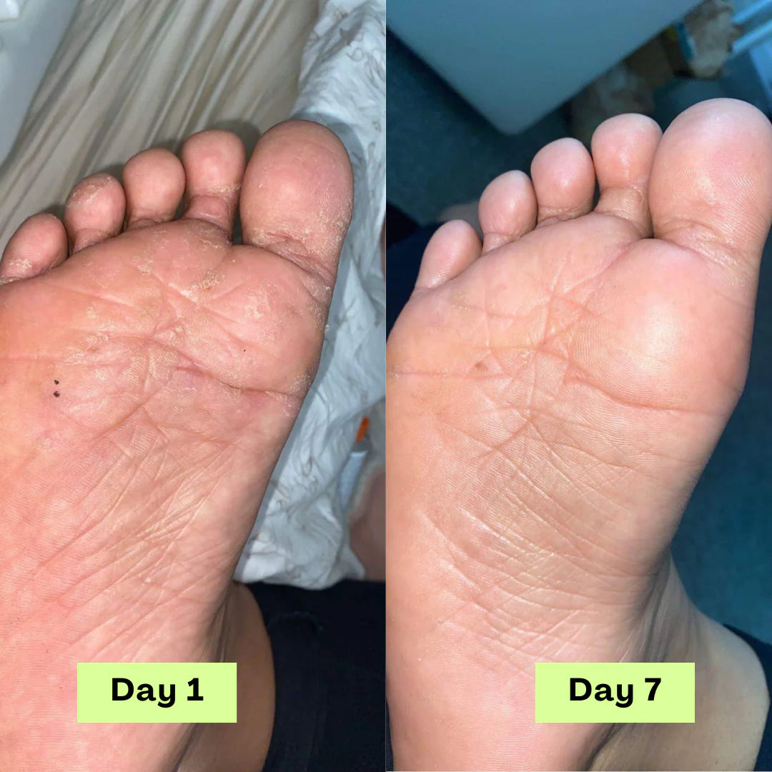 Swissclear Antifungal Soap