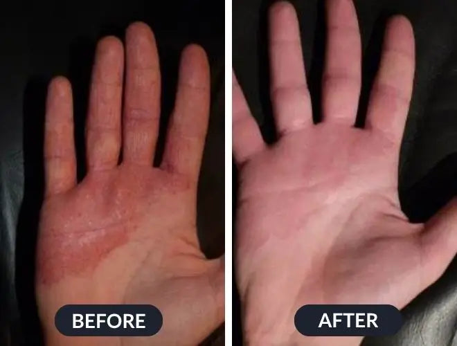 Swissclear Eczema Relief Cream