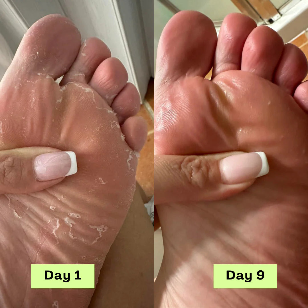 Swissclear Antifungal Soap