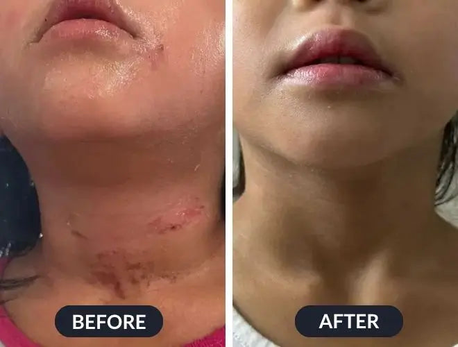 Swissclear Eczema Relief Cream
